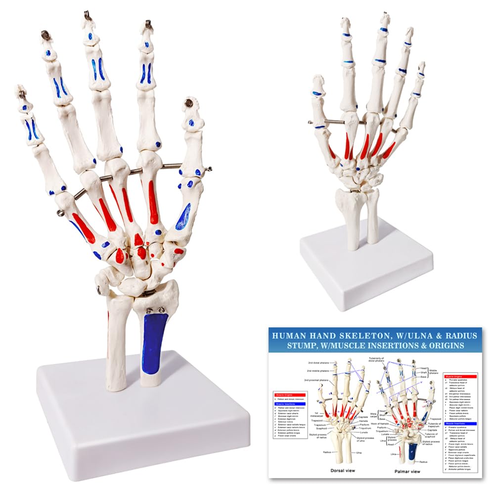 Photo 1 of EVOTECH SCIENTIFIC Hand Skeleton Model W/Articulated Joints Shows Portion of Ulna-Radius, W/Muscles Insertions & Origins Painted, W/Instruction Manual
