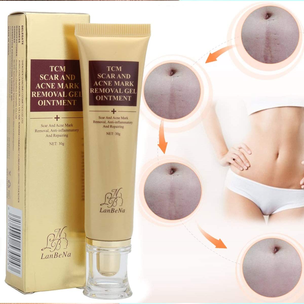 tcm scar and acne removal gel ointment