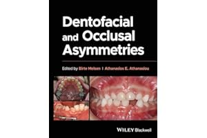 Dentofacial and Occlusal Asymmetries
