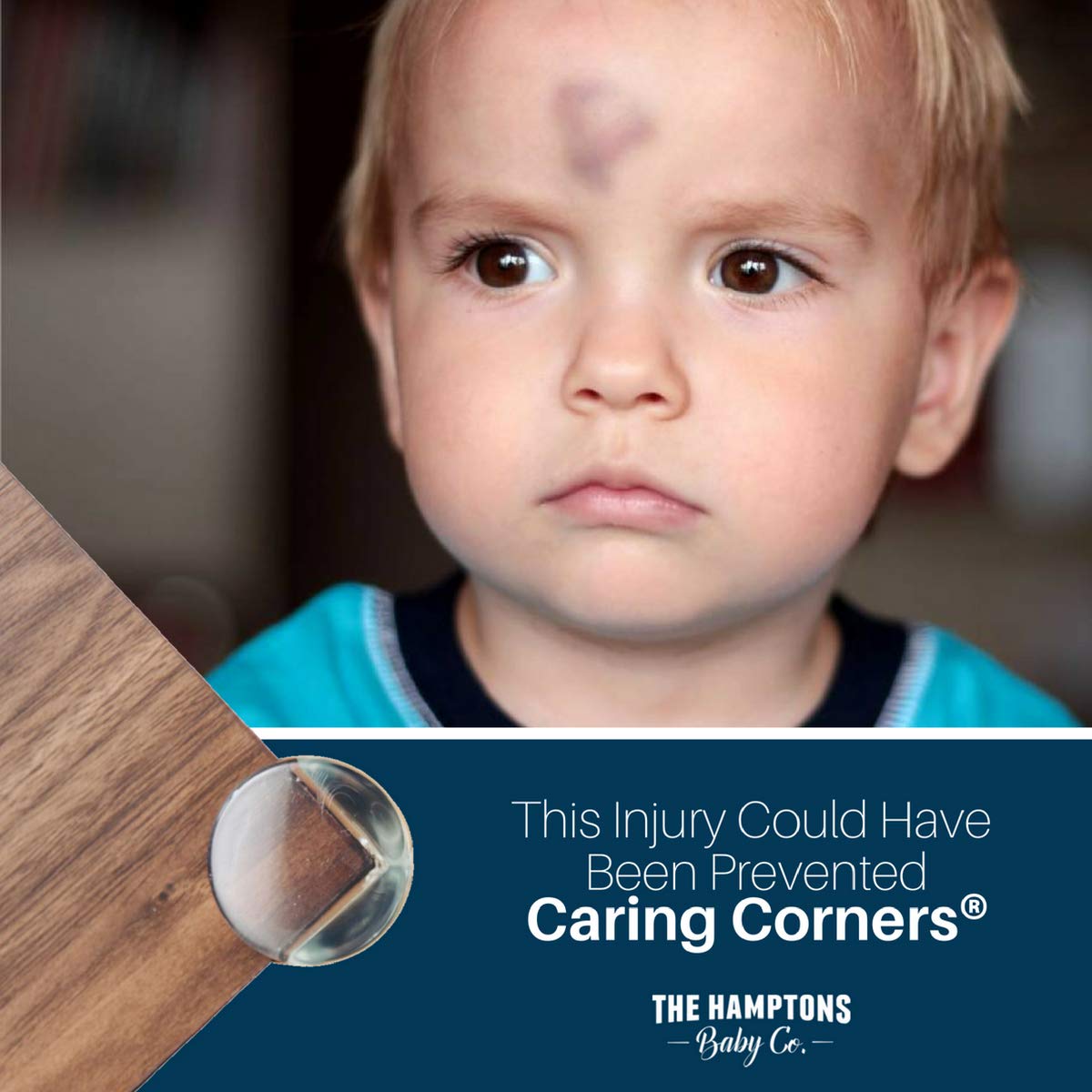 baby safety corner protectors