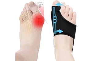 HLOES 2PCS Bunion Corrector for Women & Men Big Toe Straightener-Bunions Correction Women & Men-Bunion Splint-Bunions Pads for Bunion Relief-Hallux Valgus Pain Relief,Comfortable & Breathable for Day/Night