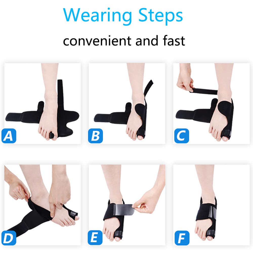 Hedume 2 Pack Bunion Corrector with Orthopedic Bunion Splint, Hallux Valgus Correction, Big Toe Straightener, Big Toe Separator Pain Relief, Day Night Support: Industrial & Scientific