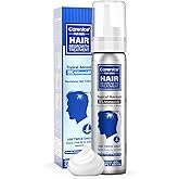 5% Topical Minoxidil Foam, Aerosol Minoxidil for Men, Infused with Biotin, Hair Growth Treatment, Supports Thicker and Fuller Hair & Beard Unscented 2.11oz Compare to Men's Rogaine's Active Ingredient