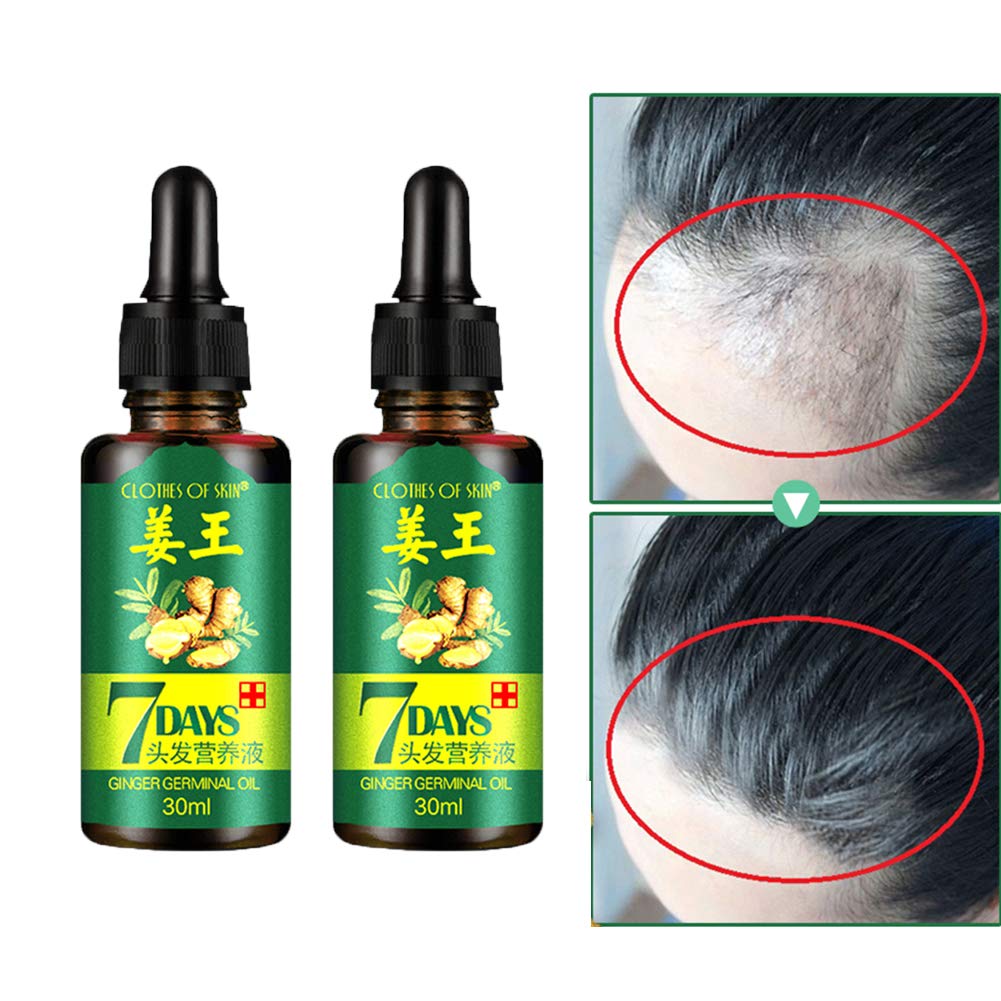 Amazon.com : Ginger Germinal Oil 30ml 2pcs, Ginger Essential Oil Hair