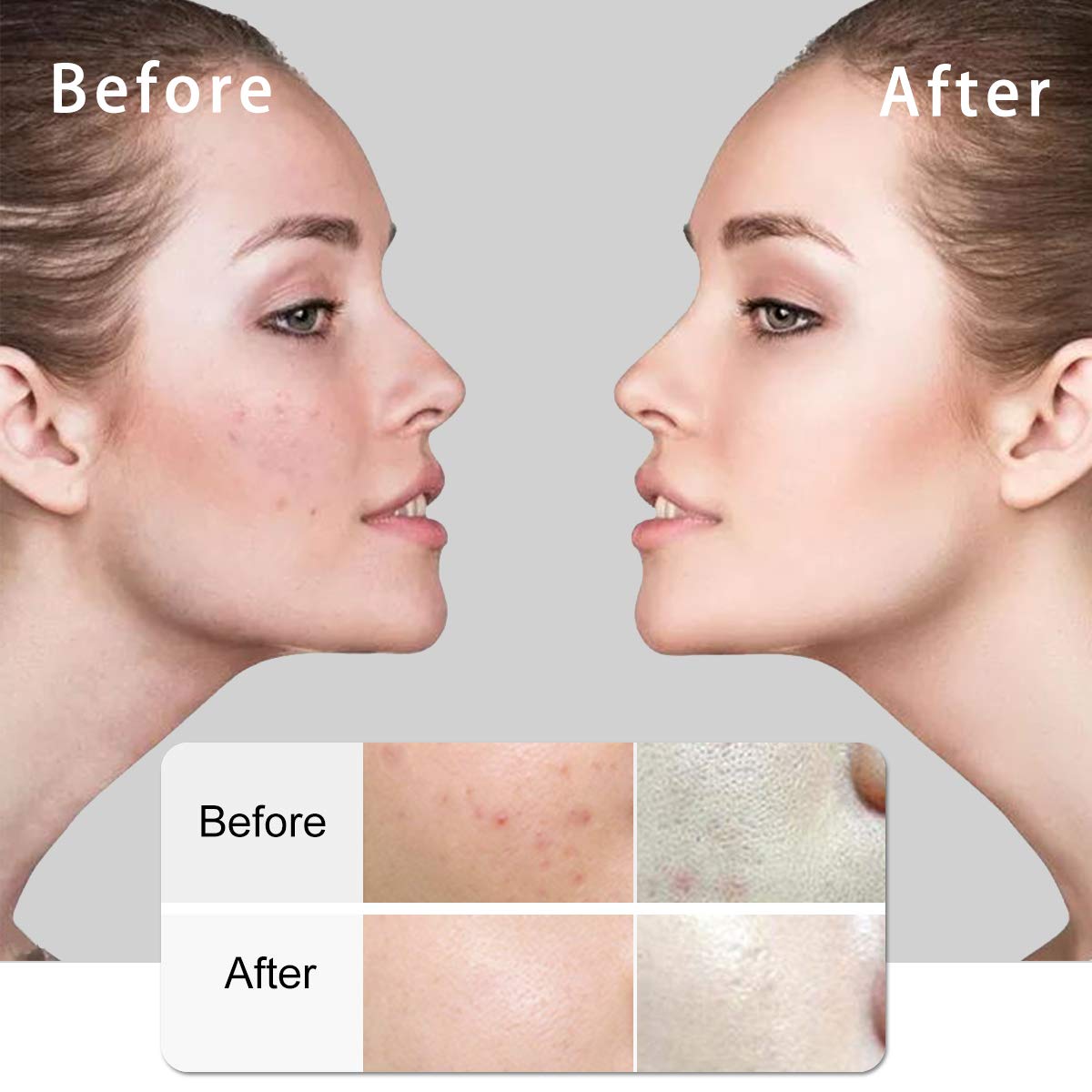 Facial Cleansing Brush, EMS & Ion Technology Dual Functional Pro Face Massage, Waterproof Face Spin Brush with 6 Brush Heads for Deep Cleansing, Gentle Exfoliating, Removing Blackhead: Beauty