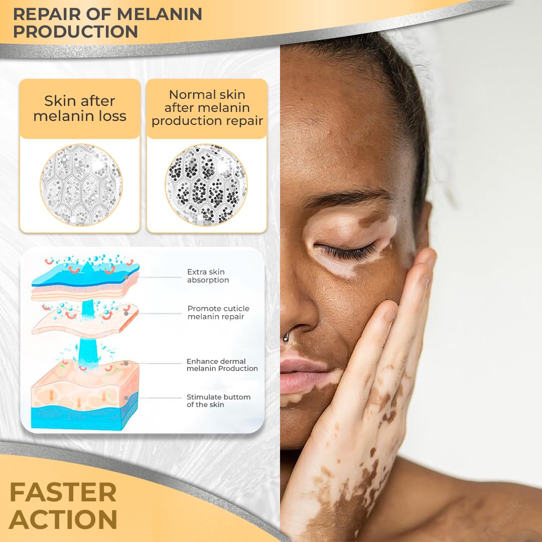 Dermawonder Vitiligo Supplement & Pigmentation Cream Set | 60 Vitiligo Capsules and 4fl Oz Cream | Reduce White Spots, Improve Skin Pigmentation & Neutralize Skin Tone | Natural Solution (1)
