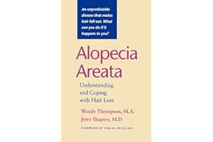 Alopecia Areata: Understanding and Coping with Hair Loss