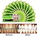 Upgraded Teeth Whitening Strips HP Professional Strength, Advanced Double Elastic Gel Strips, Custom Teeth Bleaching System, 14 Days Supply, Bonus Paper Shade Guide, Mint Flavor
