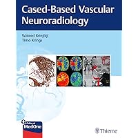 Decision Making in Neurovascular Disease: 9781684200573