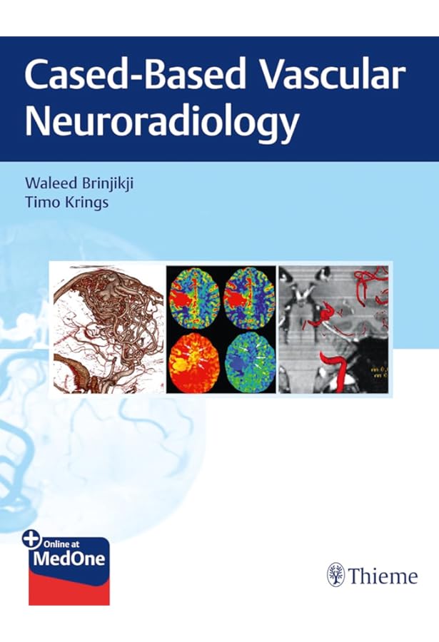 Decision Making in Neurovascular Disease: 9781684200573: Medicine