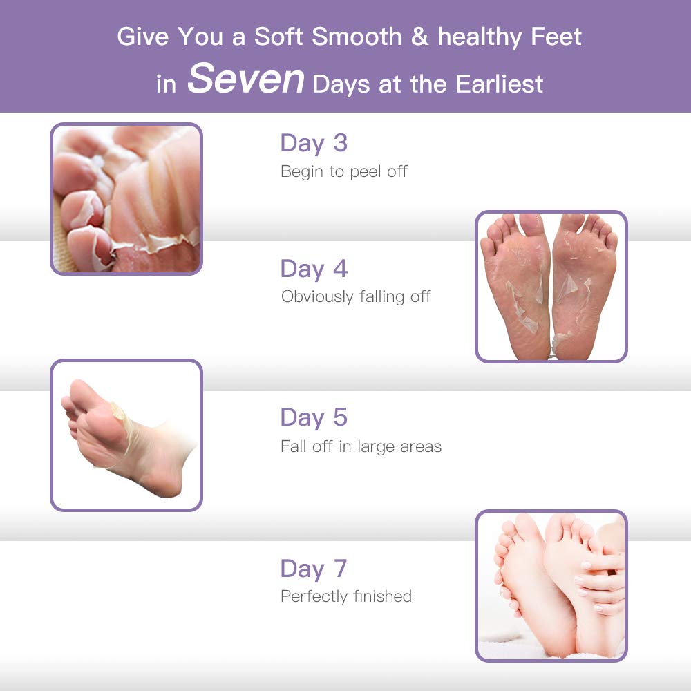 Sonkir Exfoliating Foot Mask, Peeling Away Rough Calluses and Dead Skin cells in 1-2 Weeks, Repair Exfoliant Treatment for Soft Smooth & Healthy Feet (Lavender/2 Pairs)