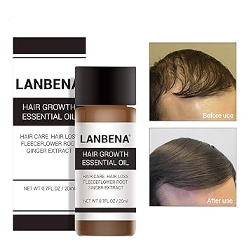 Amazon Com Hair Growth Essence Hair Loss Serum Herbal Hair