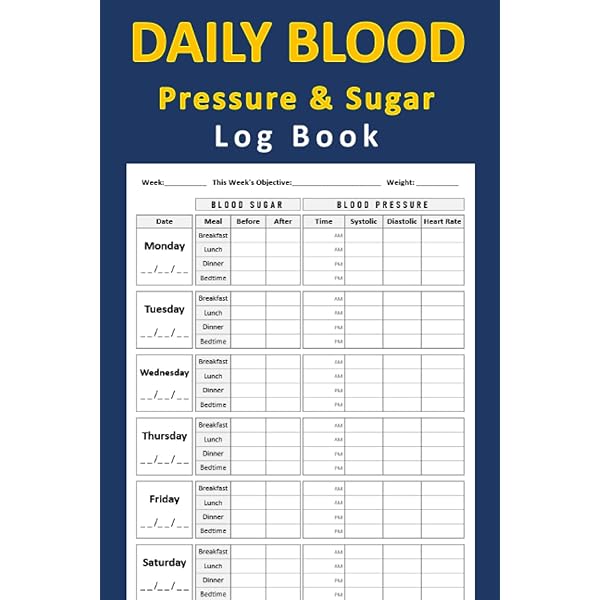 blood-sugar-log-book-2-year-blood-sugar-level-recording-book-daily-diabetic-glucose-tracker-journal-diabetes-blood-sugar-chart-peters-ali-amazon-com-books for Large Print Monthly Free Printable Blood Sugar Log Sheet Blood Sugar Log Book: 2-Year Blood Sugar Level Recording Book - Daily Diabetic Glucose Tracker Journal - Diabetes Blood Sugar Chart: Peters, Ali: Amazon.com: Books for Large Print Monthly Free Printable Blood Sugar Log Sheet