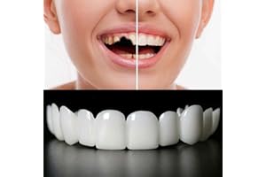 GENERIC 2 Pairs, Top and Bottom,Adjustable for Men and Women,Beautiful Smile