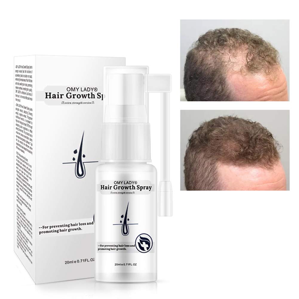 Amazon Com Wishwin Hair Growth Spray Nourish Hair Follicles