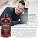Art Naturals 2 Pack - Scalp18 Coal Tar Therapeutic Anti Dandruff Shampoo 16 oz - Helps clear symptoms of Psoriasis, Eczema, Itchy Scalp & Dandruff - Made in USA with Natural & Organic Ingredients
