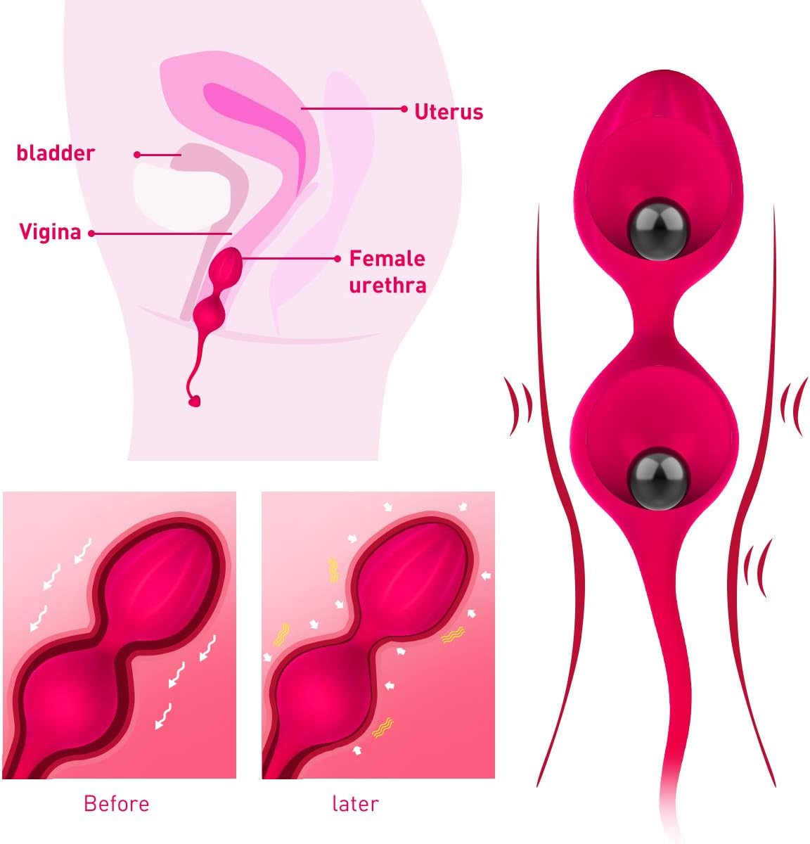 Kegel Exercise Balls for Women Ben Wa Weight Balls for Women Pelvic Exercise Ball Tightning Bladder Control Devices Silicone Strengthening Device: Health & Personal Care