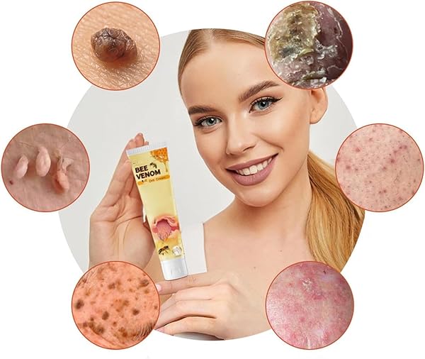 OKNIAO NEW BEE VENOM REPAIR CREAM,HYDRATING MOISTURIZING CREAM,PROFESSIONAL BEE VENOM MOISTURIZING CREAM,PROFESSIONAL BEE VENOM CREAM PROVIDES FOR ALL PARTS OF THE BODY, ALL SKIN (3PCS)