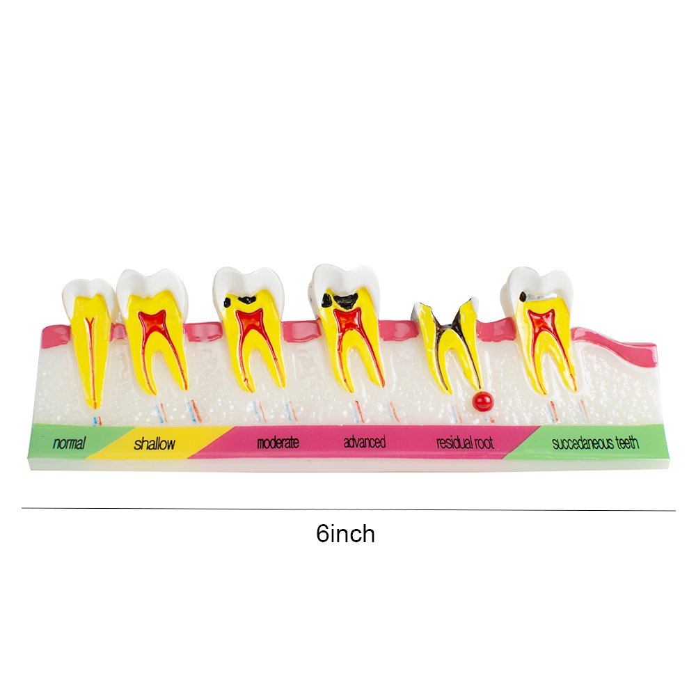 Pevor Dental Teeth Model Periodontal Disease Assort Tooth Typodont Study Teaching Model