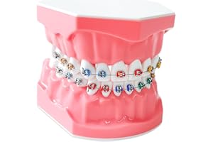 CEONAM Orthodontic Dental Model with Brackets for Educational Demonstration - Silicone Teeth Typodont with Braces, Anatomic Teaching Tool - Dental Care Training Device for Students and Patients