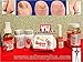 Hongosan Hongoman Nail and Skin Fungal