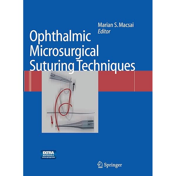 Vitreous Microsurgery: 9781608315031: Medicine & Health Science