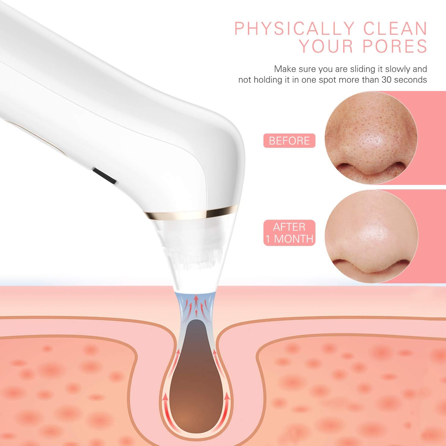 Liberex Blackhead Remover Pore Vacuum - Blue & Red Light Therapy Pore Cleanser, Diamond Microcrystalline Electric Acne Extractor, 4 Suction Heads with 5 Intensity Levels, USB Rechargeable (Rose Gold): Health & Personal Care