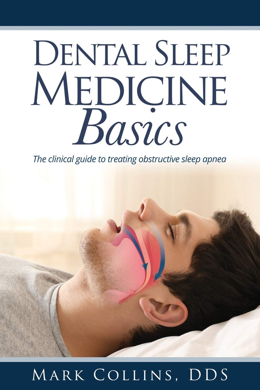 Dental Sleep Medicine Basics: The 