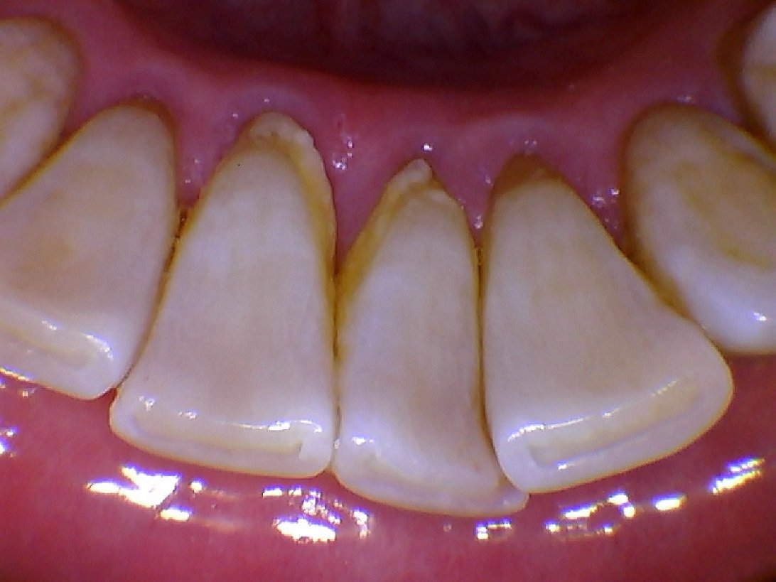 DARYOU DY50 Intraoral Camera Dental Camera ,Super Clear