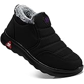 SHIBEVER Winter Boots for Women: Warm Fur Lined Slip on Ankle Snow Boots Comfortable Waterproof Anti-slip Outdoor Shoes