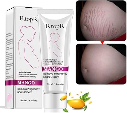 Ofanyia Stretch Mark Removal Cream Repair Scars Stretch Marks Remove Pregnancy Scar Cream Amazon Co Uk Beauty