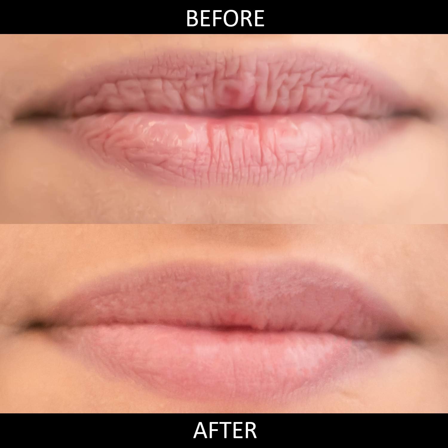 OMORFEE BE EXOTIC OF 100% Organic Hydrating Lip Balm for Dry Cracked Chapped Lips Repair & Treatment- 10 g/0.35 Oz - Image 4
