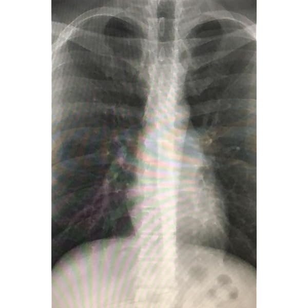 Diagnostic Imaging: Chest: 9781416023340: Medicine & Health