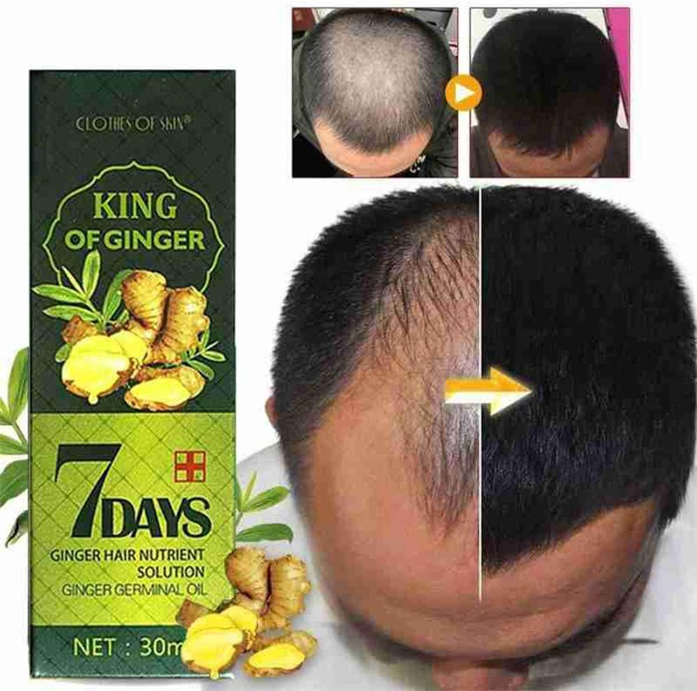Hair Growth Serum, Hair Care Products, Ginger Hair Serum, Fast Hair Growth & Thickening Oil, Stop Hair Loss, Grow Hair Fast