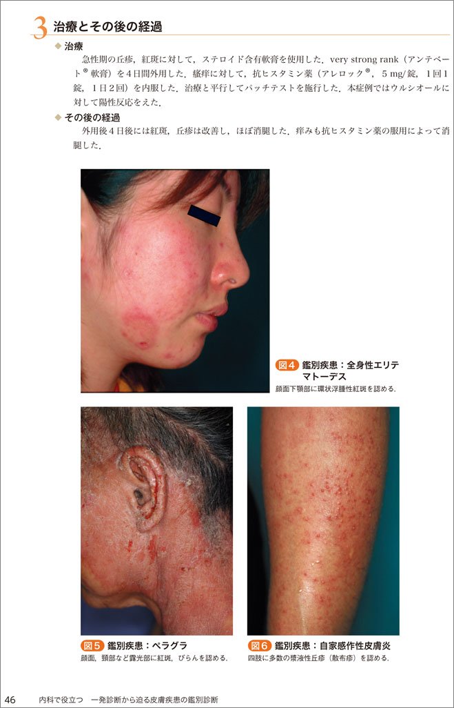 内科で役立つ 一発診断から迫る皮膚疾患の鑑別診断 Amazon Com Books
