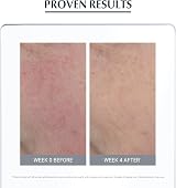 Eucerin AntiRedness Concealing Day Cream SPF25 50ml Tinted Moisturiser view 7