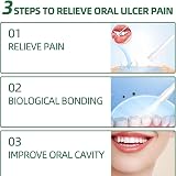 HIVETZ Mouth Ulcer Treatment Spray Herbal Breath Freshener Adults view 5