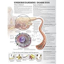 Understanding Diabetes Anatomical Chart