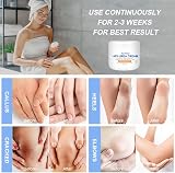ACWOO Urea Cream 40% Foot Hand Cream 150g for Cracked Heels Dry Skin Callus view 3