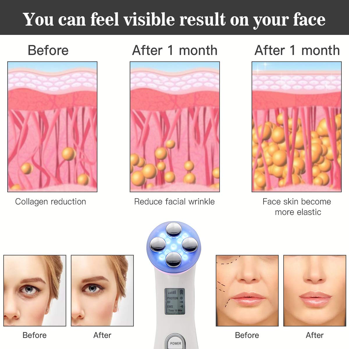 Face Lift Device Skin Firming Massager for Skin Whitening Beauty Skin Care Device MEILYLA White: Beauty
