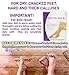 MGS Foot Peel Mask - Soft Baby Feet for Foot, 2 Pairs Lavender Exfoliating Booties Callus Remover Feet Mask for Women or Men