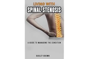 LIVING WITH SPINAL STENOSIS: A Guide To Managing The Condition - Effective Strategies To Improve The Health Of Your Spine