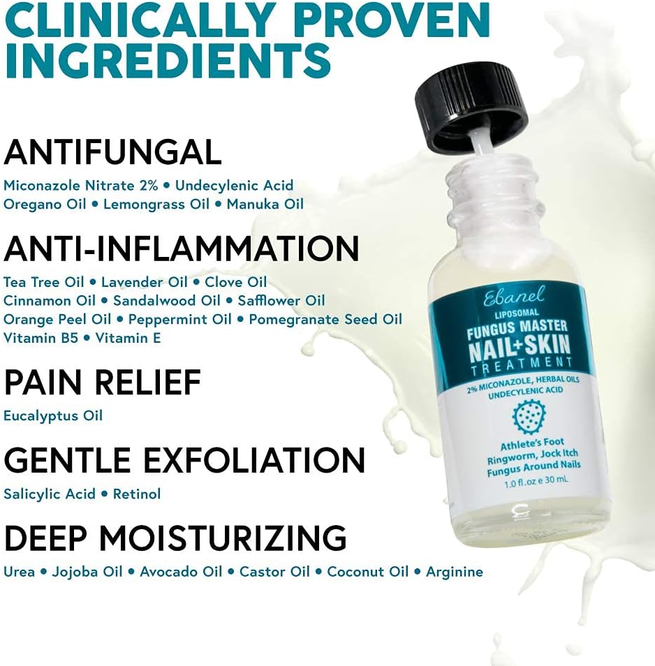 Ebanel Antifungal Treatment, 1 Oz Athletes Foot Treatment with Miconazole, Undecylenic Acid, Urea, Oregano Oil, Salicylic Acid, Kills Fungus on Skin that Leads to Nail Fungus, Ringworm Jock Itch Cream: Health & Personal Care