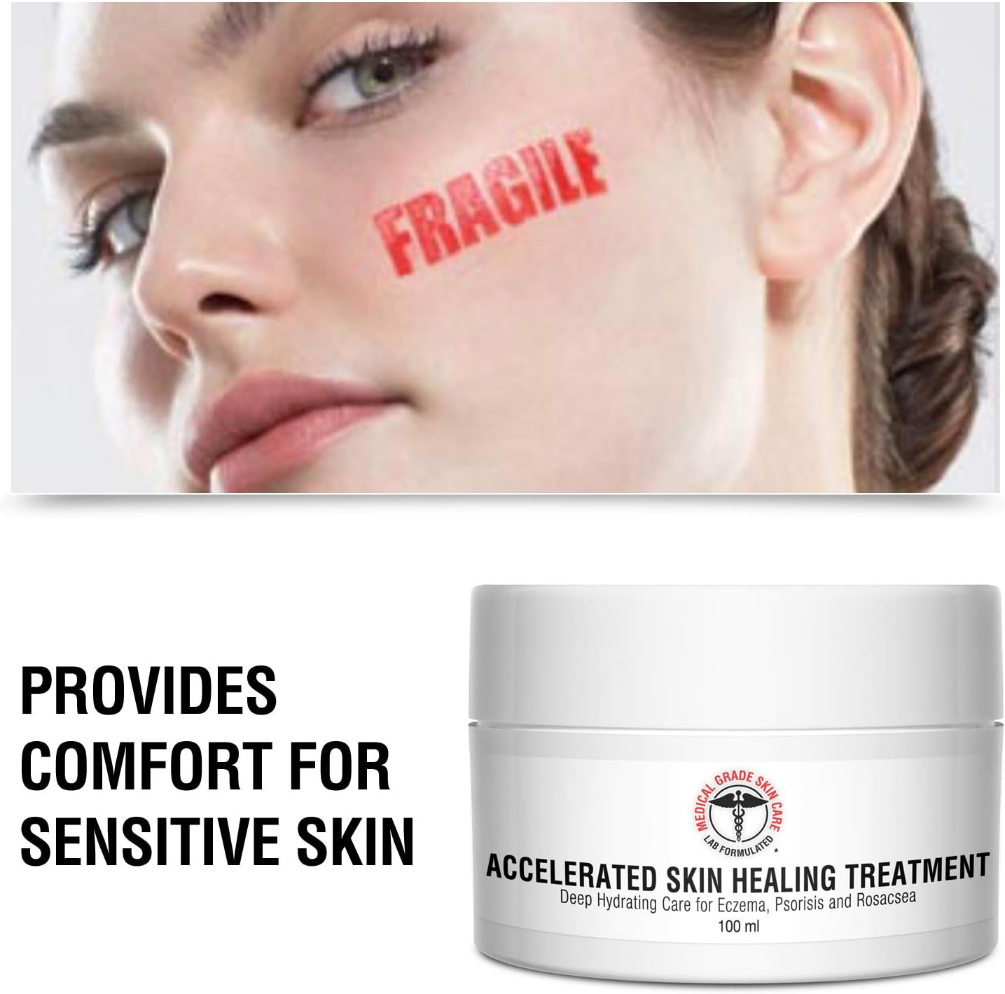 Eczema, Rosacea, Dermatitis, and Psoriasis Cream - Medical Grade Accelerated Skin Healing Treatment, Deep Hydrating Skin Lotion, Instant Skin Relief: Health & Personal Care