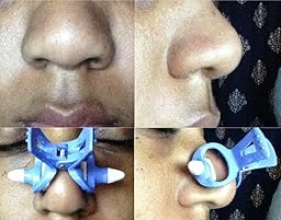 Amazon.com : Nose up Lifting Shaping & Bridge Straightening Beauty Clip