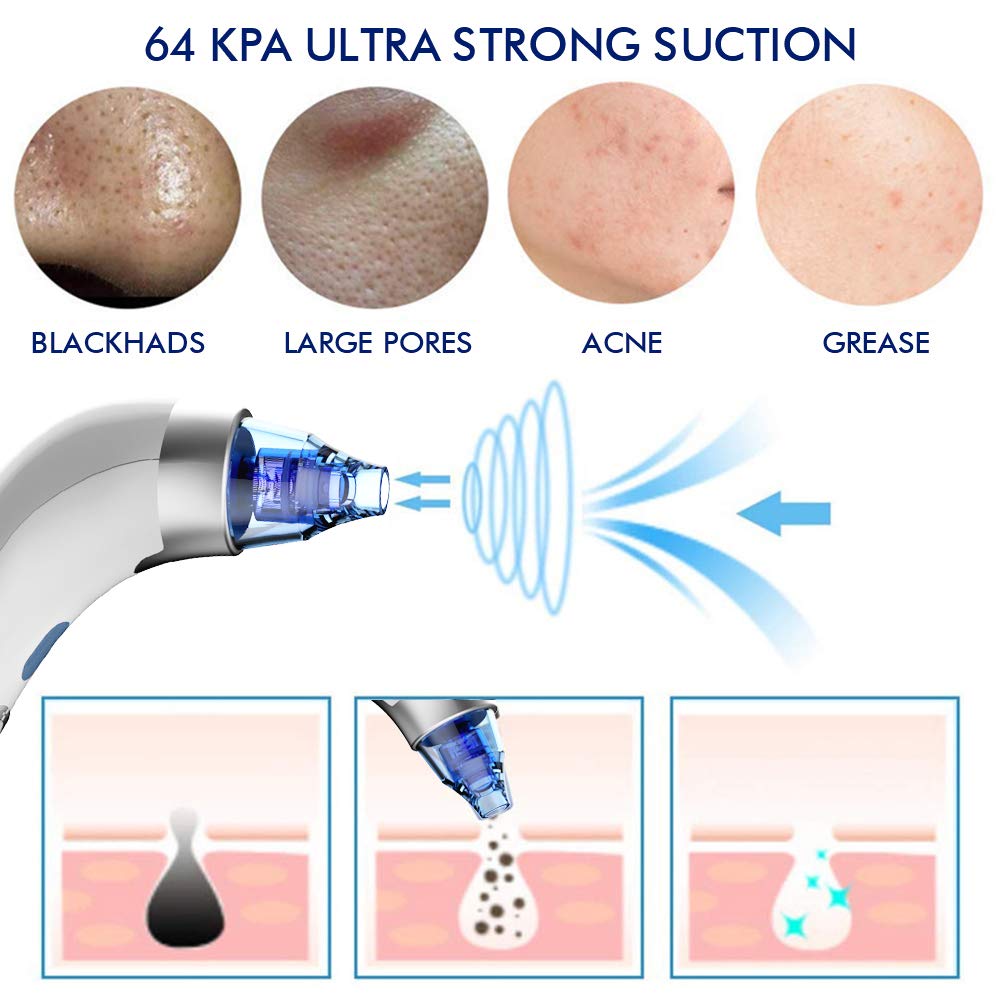 Blackhead Remover Pore Vacuum, Electric Blackhead Vacuum Cleaner Blackhead Extractor Tool Device Comedo Removal Suction Beauty Device USB Rechargeable for Women Men