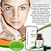 Vitamin C Serum for Face & Eyes by Skin Glow Naturals - Topical Skin Care with Vitamin C & E, Hyaluronic Acid and Organic Ingredients - Perfect for Anti-Aging, Wrinkles and Acne - 1fl oz