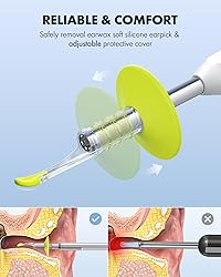 Anykit Digital Otoscope with Gyroscope, 4-inch IPS