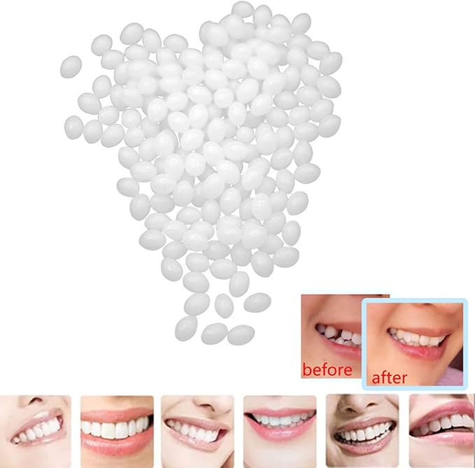 Temporary Tooth Repair Kit Moldable Thermal Fitting Beads for Snap On