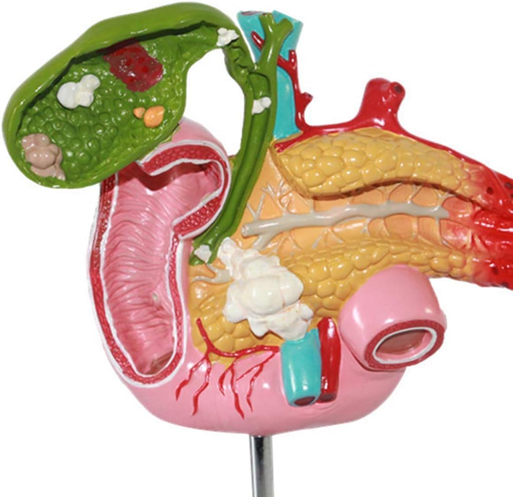 Scientific Models The Human AnatomyPathological Model of Pancreatic